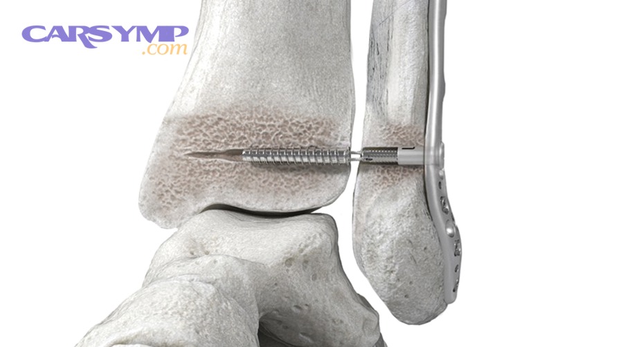 What’s included in a good repair estimate and invoice?