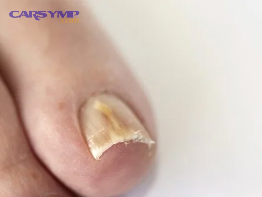 Is coolant circulation weak because of the water pump or drive belt?