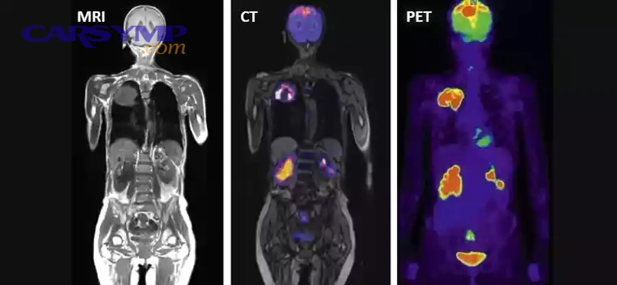 OBD2 scanner screen showing readiness and freeze frame features