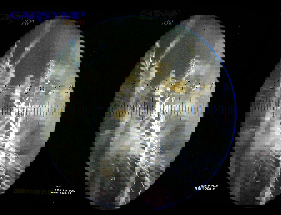 Microscopic mold grown from dust associated with a cabin air filter sample