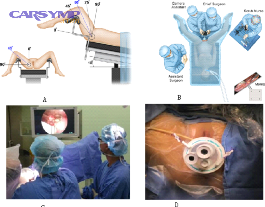 Cooling system pressure tester kit in a case with adapters
