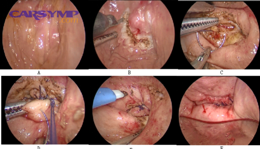 Car temperature gauge illustration with approximate coolant temperature points