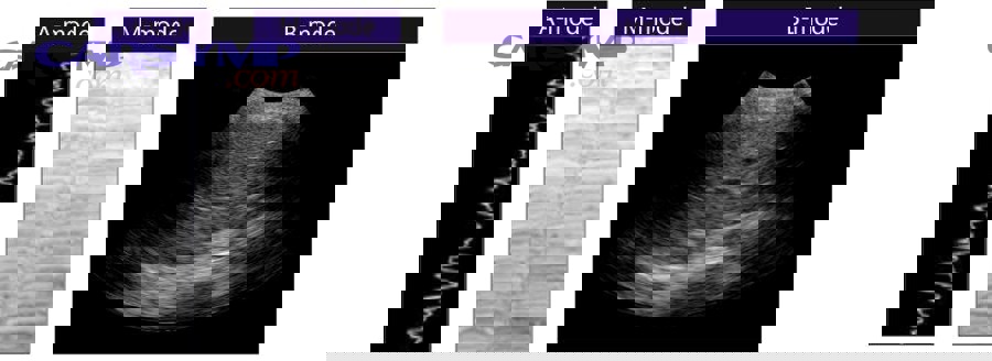 Mechanic performing diagnostic work on a car