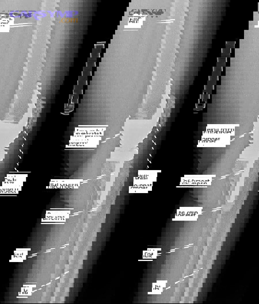 How Do You Conduct Post-Repair Noise Inspections?