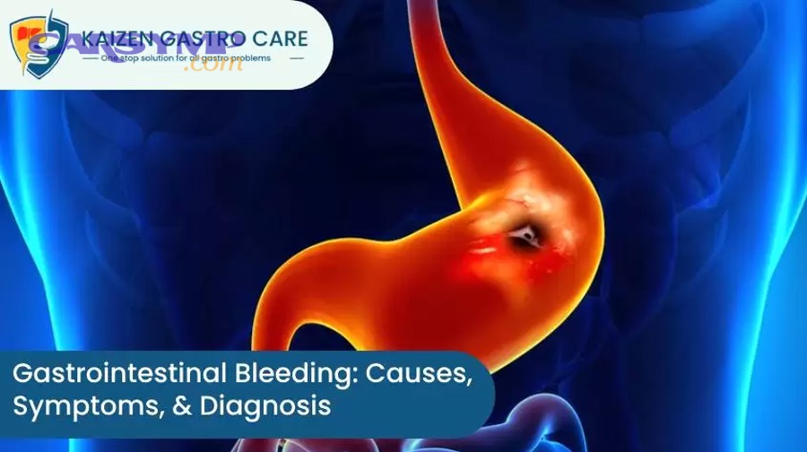 Gastrointestinal Bleeding Causes Symptoms Diagnosis