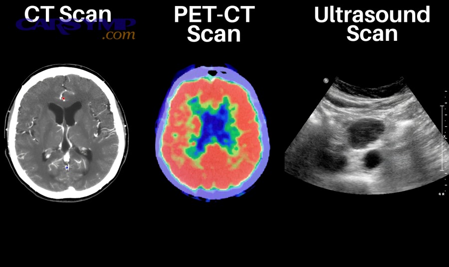 OBD2 port location illustration and example placement under the dashboard