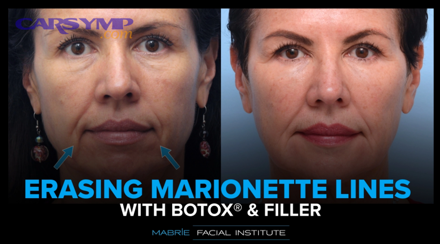 What questions should a car owner ask before approving a labor estimate?