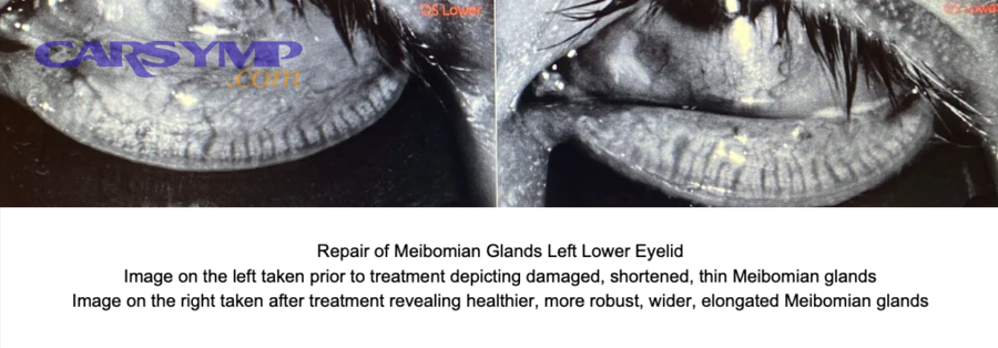 How Do You Diagnose Incorrect Fluid Levels After Setting the Procedure?