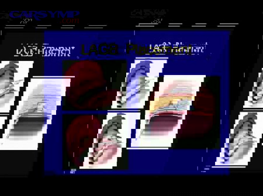 Which wheel weight types should you choose for different wheels?